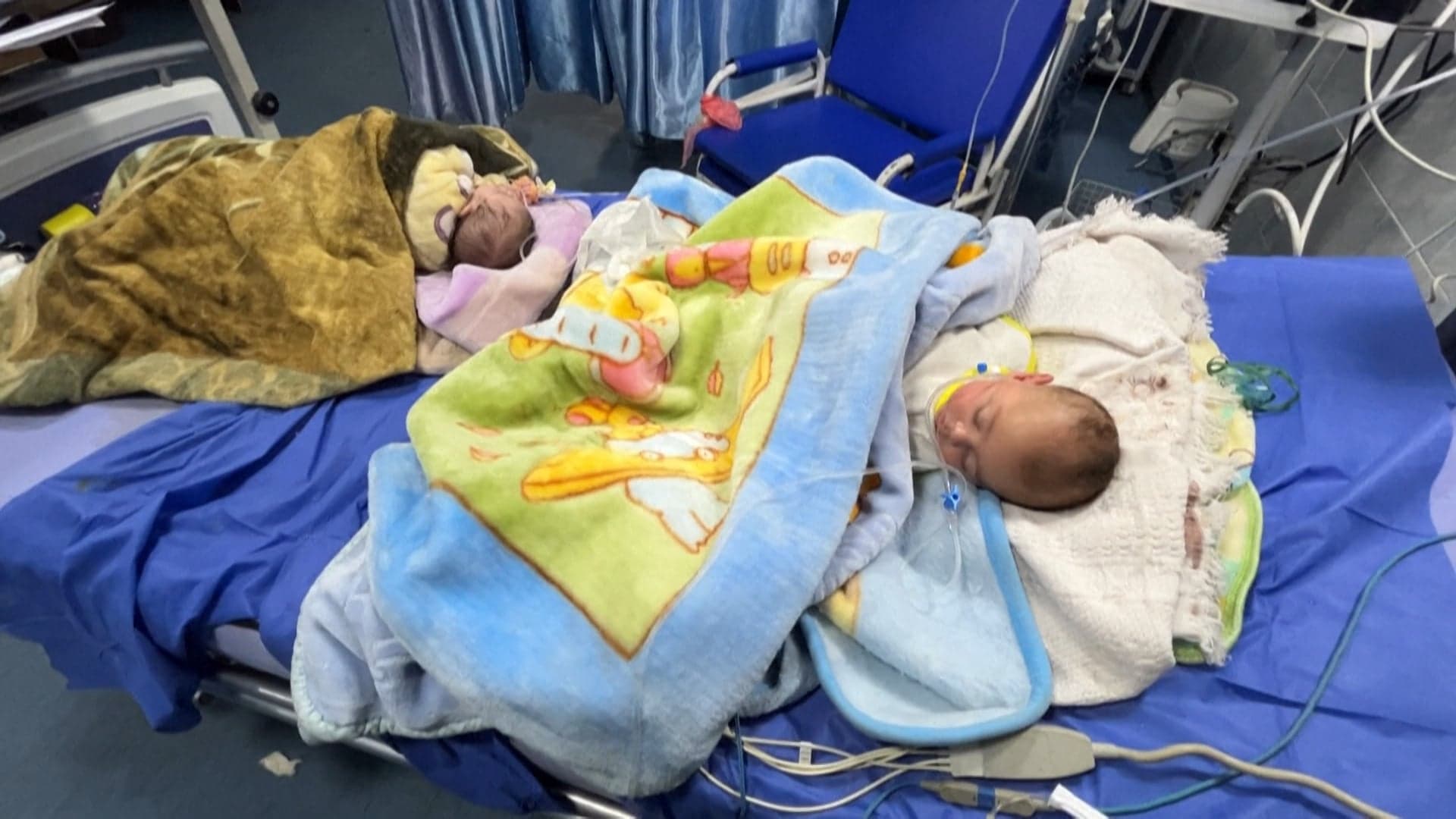 جدل طبي واجتماعي حول انتشار الولادة القيصرية بمصر