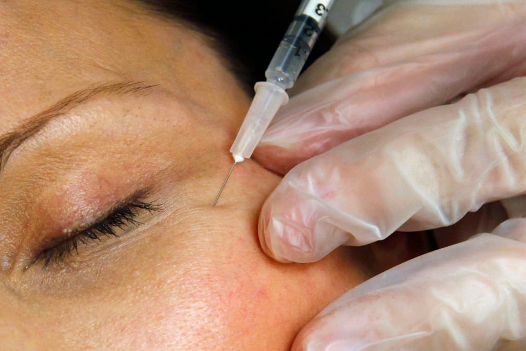 مخاطر الحقن التجميلية تفتح نقاشا حول الرقابة والمسؤولية